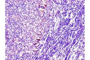 Immunohistochemistry of paraffin-embedded human lymph node tissue using ABIN7170721 at dilution of 1:100 (Stathmin 1 抗体  (AA 13-78))