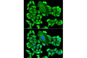 Immunofluorescence analysis of HeLa cell using MTAP antibody. (MTAP 抗体)