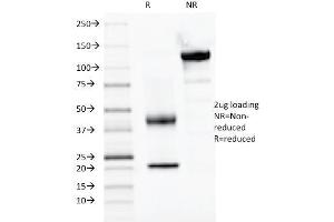 SDS-PAGE Analysis Purified PAX2, Monoclonal Antibody (PAX2/1104). (PAX2A 抗体  (AA 223-354))