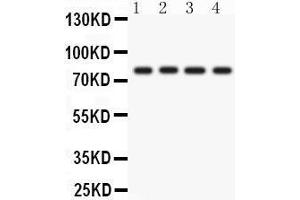 Western Blotting (WB) image for anti-Protein Kinase C, eta (PRKCH) (AA 30-389) antibody (ABIN3043361) (PKC eta 抗体  (AA 30-389))