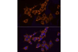 Immunofluorescence analysis of PC-12 cells using Bag1 Rabbit mAb (ABIN7265847) at dilution of 1:50 (40x lens). (BAG1 抗体)