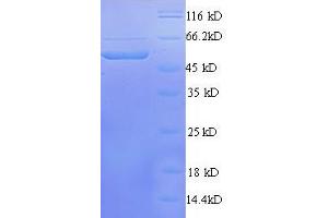 Calcium/calmodulin-Dependent Protein Kinase IV (CAMK4) (AA 1-474) protein (His tag) expressed in E.