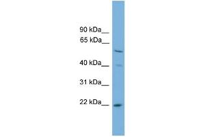 WB Suggested Anti-UBE2T Antibody Titration: 0. (Ube2t 抗体  (N-Term))