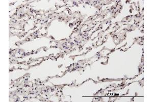 Immunoperoxidase of purified MaxPab antibody to NT5C on formalin-fixed paraffin-embedded human lung. (NT5C 抗体  (AA 1-117))