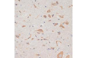 Immunohistochemistry of paraffin-embedded mouse spinal cord using  antibody (ABIN6129209, ABIN6137382, ABIN6137383 and ABIN6219595) at dilution of 1:100 (40x lens). (AXIN2 抗体  (AA 650-750))