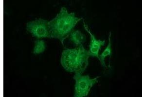 Immunofluorescence (IF) image for anti-Myotubularin Related Protein 14 (MTMR14) antibody (ABIN1499588) (MTMR14 抗体)