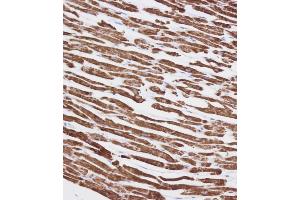 Immunohistochemistry (Paraffin-embedded Sections) (IHC (p)) image for anti-Voltage-Dependent Anion Channel 3 (VDAC3) (AA 156-183) antibody (ABIN1537893)