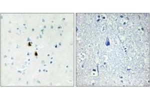 Immunohistochemistry analysis of paraffin-embedded human brain tissue, using IPKA Antibody.