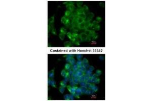 ICC/IF Image Immunofluorescence analysis of methanol-fixed mouse ESC, using SIPA1, antibody at 1:200 dilution.