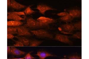 Immunofluorescence analysis of C6 cells using N-WASP Polyclonal Antibody at dilution of 1:100 (40x lens).