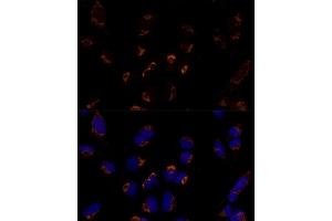 Immunofluorescence analysis of U-2 OS cells using MTCH2 Polyclonal Antibody  at dilution of 1:100 (40x lens). (MTCH2 抗体  (AA 30-175))