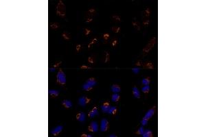 Immunofluorescence analysis of U-2 OS cells using MTCH2 Polyclonal Antibody  at dilution of 1:100 (40x lens). (MTCH2 抗体  (AA 30-175))