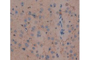 IHC-P analysis of brain tissue, with DAB staining. (DLG5 抗体  (AA 1724-1917))