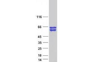 Validation with Western Blot (ANKRD34A Protein (Myc-DYKDDDDK Tag))