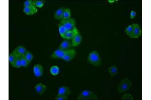 Immunofluorescence staining of HepG2 cells with ABIN7127390 at 1:33, counter-stained with DAPI. (Recombinant CCR9 抗体)