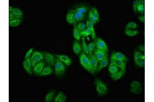 Immunofluorescence staining of HepG2 cells with ABIN7172695 at 1:100, counter-stained with DAPI. (TAF7L 抗体  (AA 1-98))