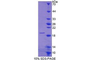 SDS-PAGE analysis of Human CNRIP1 Protein. (Cnrip1 蛋白)