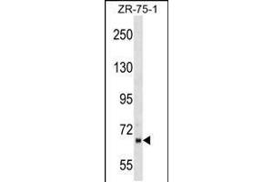 Western blot analysis in ZR-75-1 cell line lysates (35ug/lane). (PPWD1 抗体  (AA 236-262))