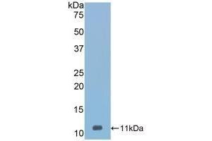 Detection of Recombinant Vaspin, Mouse using Polyclonal Antibody to Visceral Adipose Tissue Derived Serine Protease Inhibitor (Vaspin) (SERPINA12 抗体  (AA 71-148))