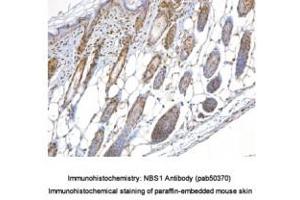 Image no. 1 for anti-NLR Family, Pyrin Domain Containing 2 (NLRP2) (AA 150-200) antibody (ABIN363677) (NLRP2 抗体  (AA 150-200))
