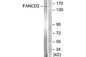 Western Blotting (WB) image for anti-Fanconi Anemia, Complementation Group D2 (FANCD2) (AA 188-237) antibody (ABIN2888629) (FANCD2 抗体  (AA 188-237))