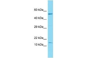 Host: Rabbit Target Name: C17orf103 Sample Type: Fetal Brain lysates Antibody Dilution: 1. (GTLF3B 抗体  (N-Term))