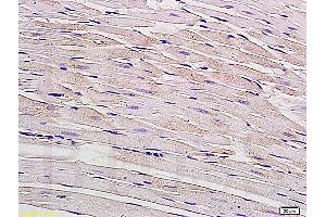 Formalin-fixed and paraffin embedded rat myocardium tissue labeled with Anti-Connexin-40 Polyclonal Antibody, Unconjugated (ABIN736926) at 1:200, followed by conjugation to the secondary antibody and DAB staining (Cx40/GJA5 抗体  (AA 301-358))
