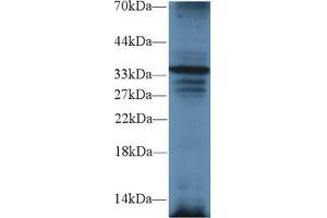 Western blot analysis of Mouse Liver lysate, using Mouse TRADD Antibody (2 µg/ml) and HRP-conjugated Goat Anti-Rabbit antibody (