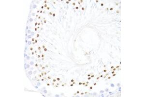 Immunohistochemistry of paraffin-embedded rat testis using DDX59 antibody (ABIN7266702) at dilution of 1:100 (40x lens). (DDX59 抗体  (AA 1-250))