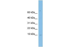 WB Suggested Anti-LSM6 Antibody Titration: 0. (LSM6 抗体  (Middle Region))