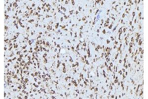 ABIN6272861 at 1/100 staining Mouse brain tissue by IHC-P. (ADAM12 抗体  (N-Term))