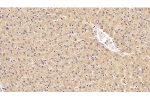 Detection of CEACAM1 in Human Liver Tissue using Monoclonal Antibody to Carcinoembryonic Antigen Related Cell Adhesion Molecule 1 (CEACAM1) (CEACAM1 抗体)