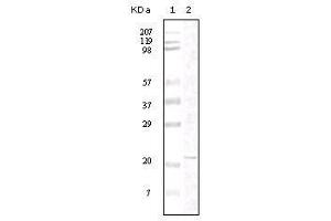 Western Blot showing FAK antibody used against truncated FAK recombinant protein. (FAK 抗体)