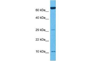 Host:  Rabbit  Target Name:  TNFRSF12A  Sample Tissue:  Mouse Thymus  Antibody Dilution:  1ug/ml (TNFRSF12A 抗体  (N-Term))