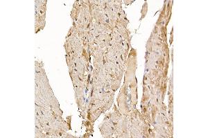 Immunohistochemistry of paraffin-embedded mouse heart using RC Rabbit pAb (ABIN6129452, ABIN6146811, ABIN6146812 and ABIN6220955) at dilution of 1:150 (40x lens).