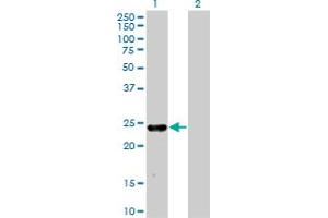 Western Blot analysis of MXI1 expression in transfected 293T cell line by MXI1 monoclonal antibody (M08), clone 1F3.