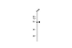 Anti-DK2 Antibody (M1)at 1:2000 dilution + Hela whole cell lysates Lysates/proteins at 20 μg per lane. (DAPK2 抗体  (N-Term))