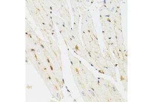 Immunohistochemistry of paraffin-embedded mouse heart using THAP1 antibody (ABIN5975558) at dilution of 1/100 (40x lens). (THAP1 抗体)