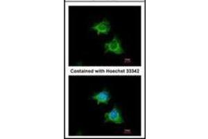 Immunofluorescence analysis of methanol-fixed HeLa, using BIRC4 antibody at 1/100 dilution. (XIAP 抗体  (AA 75-226))