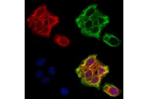 ABIN6265622 and ABIN6273178 staining Hela cells by IF/ICC.