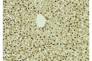 Immunohistochemistry (IHC) image for anti-Phosphatidylinositol-4-Phosphate 5-Kinase, Type I, alpha (PIP5K1A) (N-Term) antibody (ABIN6264231)