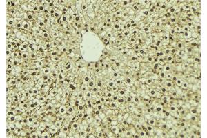 ABIN6273298 at 1/100 staining Mouse liver tissue by IHC-P. (PIP5K1A 抗体  (N-Term))