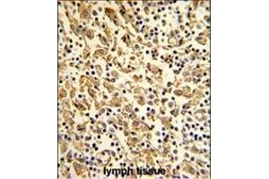 Immunohistochemistry (Paraffin-embedded Sections) (IHC (p)) image for anti-Exportin, tRNA (Nuclear Export Receptor For TRNAs) (XPOT) (AA 137-166), (N-Term) antibody (ABIN391952)