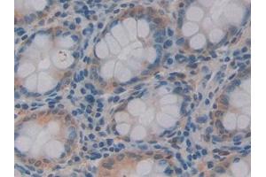 Used in DAB staining on fromalin fixed paraffin- embedded Kidney tissue (REG3g 抗体  (AA 87-175))