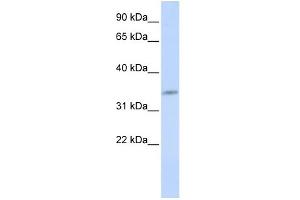 WB Suggested Anti-CDK5 Antibody Titration:  0. (CDK5 抗体  (N-Term))