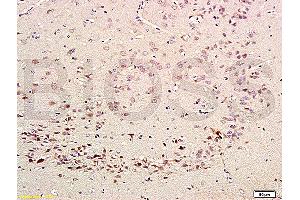Formalin-fixed and paraffin embedded rat brain labeled with Rabbit Anti-CDK5 Polyclonal Antibody (ABIN670101) at 1:200 followed by conjugation to the secondary antibody and DAB staining. (CDK5 抗体  (AA 15-100))
