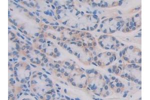 Detection of IL11Ra in Mouse Small intestine Tissue using Polyclonal Antibody to Interleukin 11 Receptor Alpha (IL11Ra)