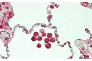 Detection of CHI3L1 in Human Lung Tissue using Polyclonal Antibody to Chitinase-3-like Protein 1 (CHI3L1)