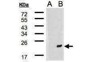 WB Image Western Blot analysis of DNAJB9 expression in transfected 293T cell line by DNAJB9 polyclonal antibody. (DNAJB9 抗体  (C-Term))