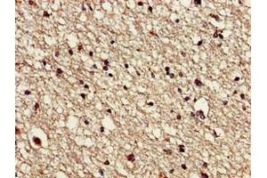 Immunohistochemistry of paraffin-embedded human brain tissue using ABIN7175666 at dilution of 1:100 (VPS16 抗体  (AA 7-89))